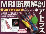 MRI断層解剖アトラス 第2版 3Dで見る骨と筋 中古本・書籍