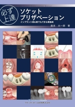 必ず上達 ソケットプリザベーション : インプラント初心者でもできる骨造成 必ず上達 ソケットプリザベーション インプラント初心者でも