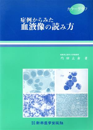 カラーグラフ 症例からみた血液像の読み方