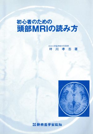初心者のための頭部MRIの読み方