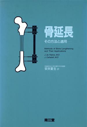 骨延長 その方法と適用