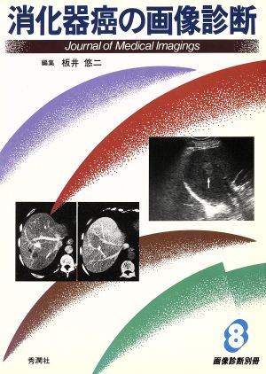 消化器癌の画像診断 画像診断別冊8