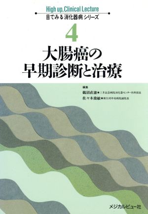 大腸癌の早期診断と治療 目でみる消化器病シリーズ4