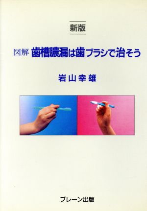 新版 図解歯槽膿漏は歯ブラシで治そう