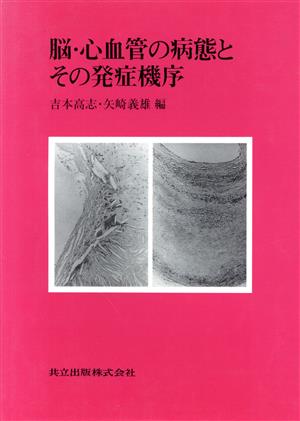 脳・心血管の病態とその発症機序