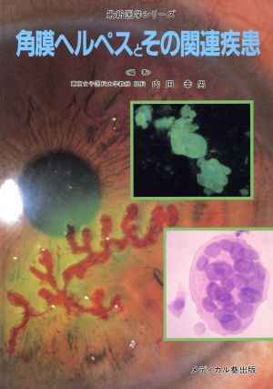 角膜ヘルペスとその関連疾患最新医学シリーズ