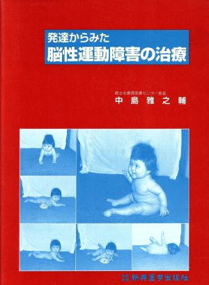 発達からみた脳性運動障害の治療