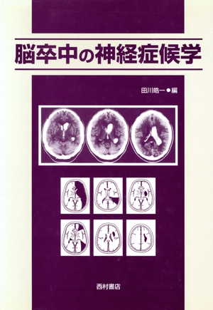 脳卒中の神経症候学