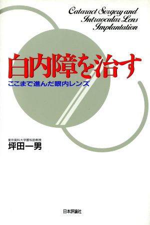 白内障を治す ここまで進んだ眼内レンズ