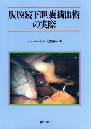 腹腔鏡下胆嚢摘出術の実際