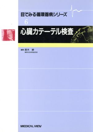 心臓カテーテル検査 目でみる循環器病シリーズ6