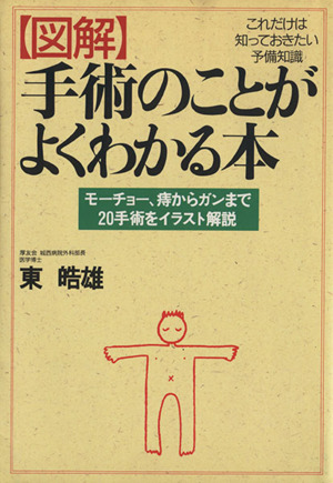 図解 手術のことがよくわかる本 モーチョー、痔からガンまで20手術をイラスト解説