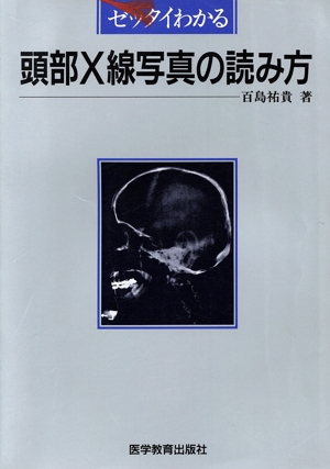 ゼッタイわかる頭部X線写真の読み方