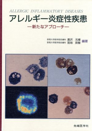 アレルギー炎症性疾患 新たなアプローチ