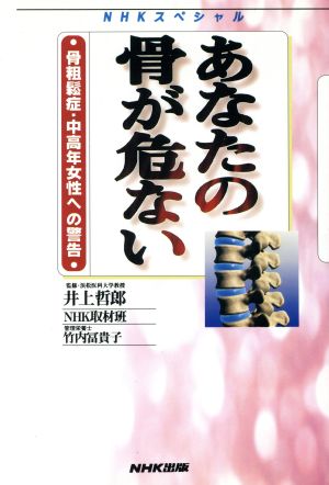 NHKスペシャル あなたの骨が危ない骨粗鬆症・中高年女性への警告NHKスペシャル