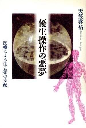 優生操作の悪夢 医療による生と死の支配