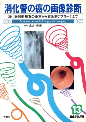消化管の癌の画像診断 消化管診断検査の基本から診断的アプローチまで 画像診断別冊13