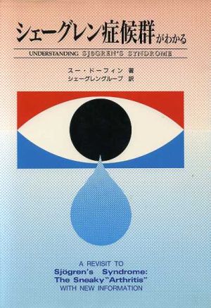 ジェーグレン症候群がわかる