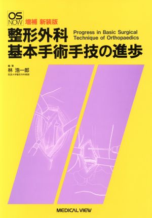 整形外科基本手術手技の進歩 OS NOW