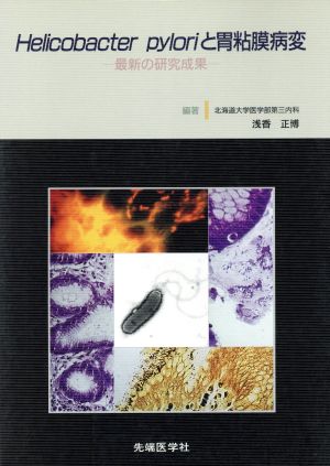 Helicobacter pyloriと胃粘膜病変 最新の研究成果