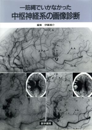 一筋縄ではいかなかった中枢神経系の画像診断