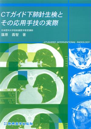 CTガイド下肺針生検とその応用手技の実際