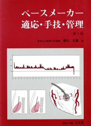 ペースメーカー適応・手技・管理