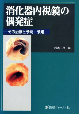 消化器内視鏡の偶発症 その治療と予防・予知