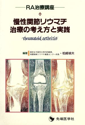 慢性関節リウマチ治療の考え方と実践 RA治療講座