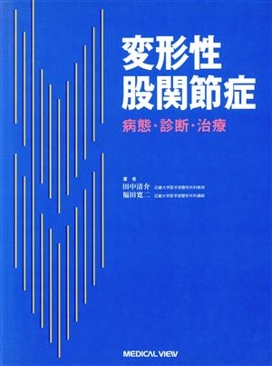 変形性股関節症 病態・診断・治療