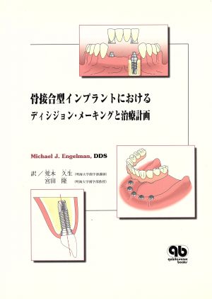 骨接合型インプラントにおけるディシジョン・メーキングと治療計画