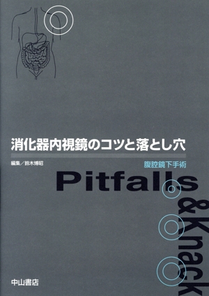 消化器内視鏡のコツと落とし穴 腹腔鏡下手術