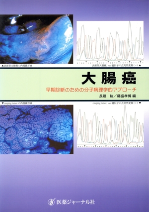 大腸癌 早期診断のための分子病理学的アプローチ