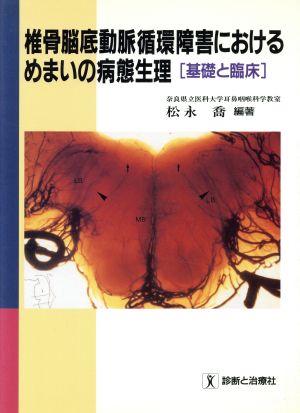 椎骨脳底動脈循環障害におけるめまいの病態生理「基礎と臨床」 基礎と臨床