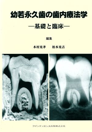 幼若永久歯の歯内療法学基礎と臨床quintessence books
