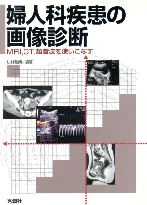 婦人科疾患の画像診断 MRI・CT・超音波を使いこなす