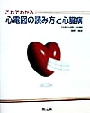 これでわかる心電図の読み方と心臓病