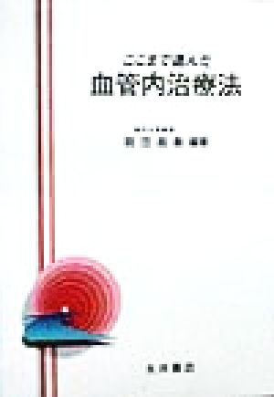 ここまで進んだ血管内治療法 今日の治療