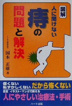 図解 人に聞けない痔の問題と解決