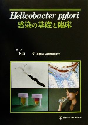 Helicobacter pylori感染の基礎と臨床