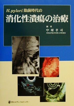 H.pylori除菌時代の消化性潰瘍の治療