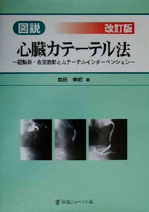 図説・心臓カテーテル法 冠動脈・左室造影とカテーテルインターベンション