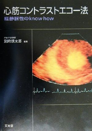 心筋コントラストエコー法 経静脈性のknow how