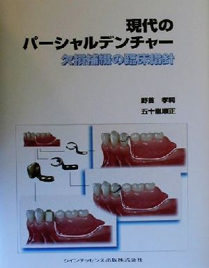 現代のパーシャルデンチャー 欠損補綴の臨床指針