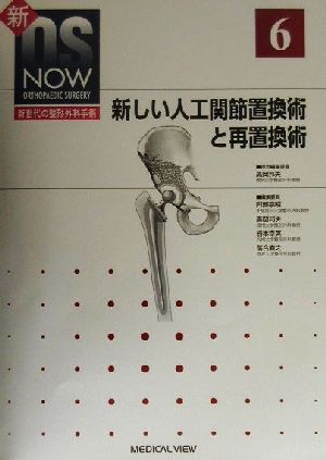 新しい人工関節置換術と再置換術 新OS NOWno.6新世代の整形外科手術No.6