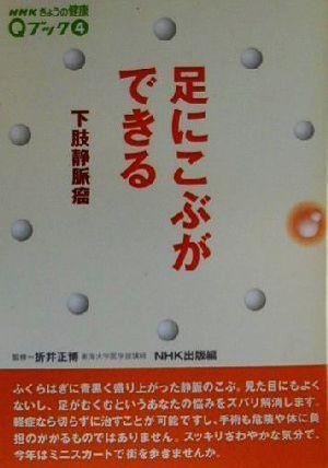 足にこぶができる 下肢静脈瘤 NHKきょうの健康Qブック4Qブック4