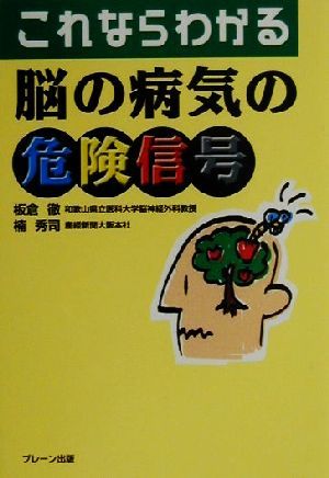 これならわかる脳の病気の危険信号