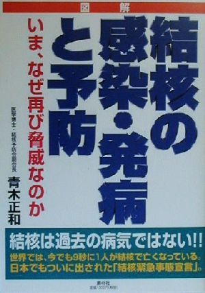 図解 結核の感染・発病と予防 いま、なぜ再び脅威なのか