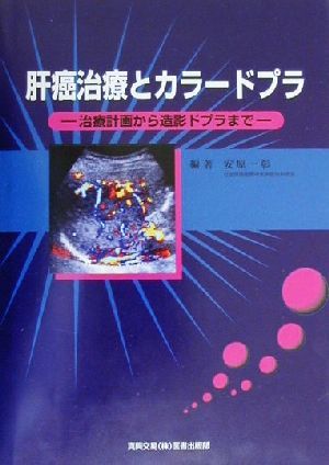 肝癌治療とカラードプラ 治療計画から造影ドプラまで