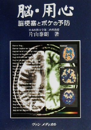 脳・用心 脳梗塞とボケの予防